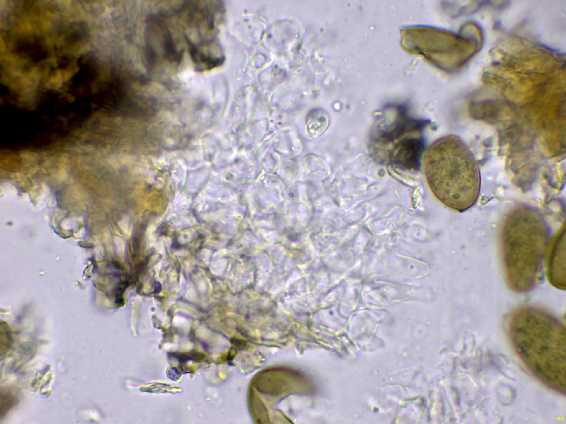 Microscopía de Sphaeropsis foliicola - 10 - Hifas conidiógenas agua-002